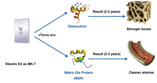 CALCIFIED BONES NOT VESSELS!