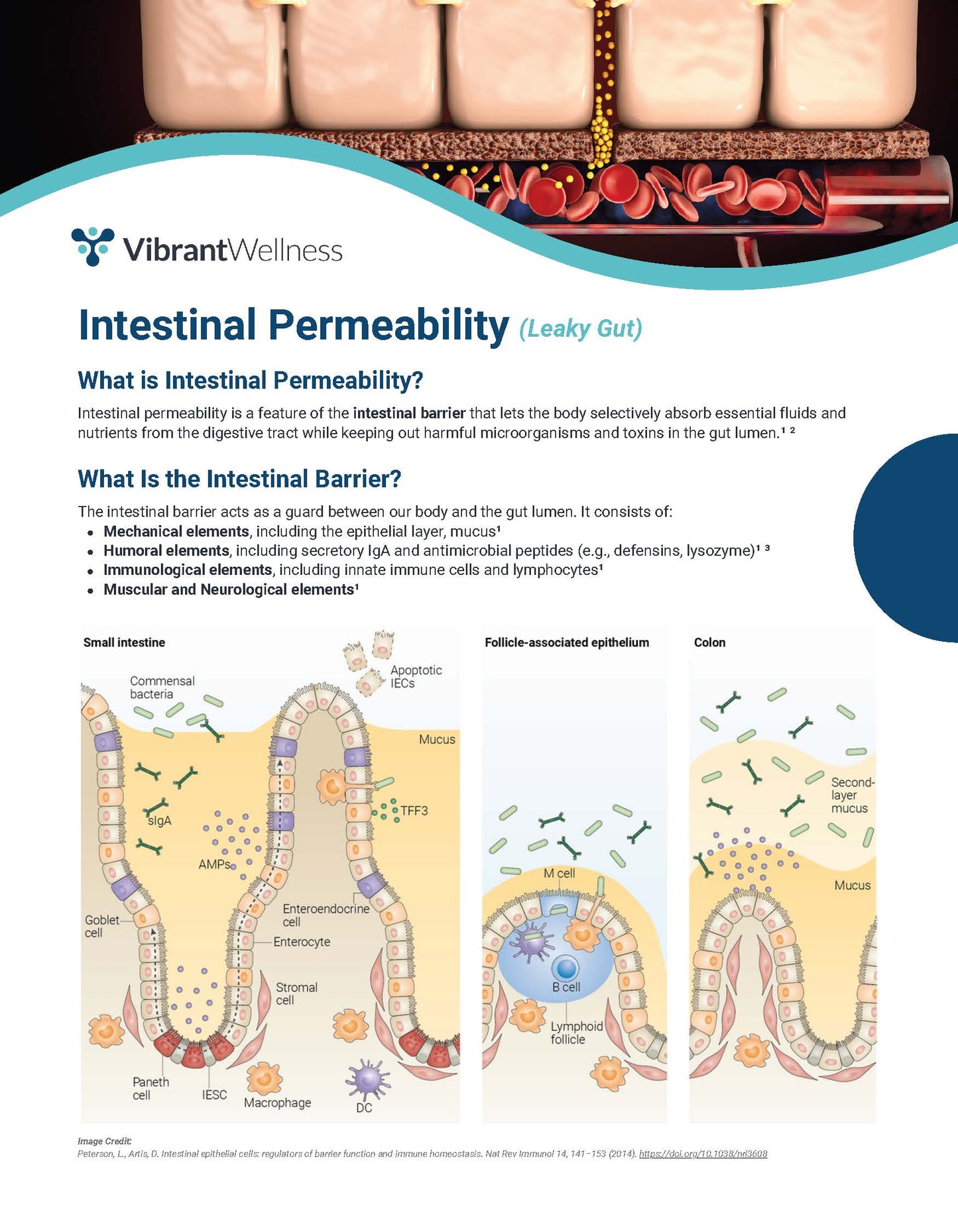 Neurologic Health Screening, Intestinal Permeability (Leaky Gut) and and Gluten Sensitivity