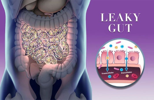 Leaky Gut, Inflammation and Bowel Health