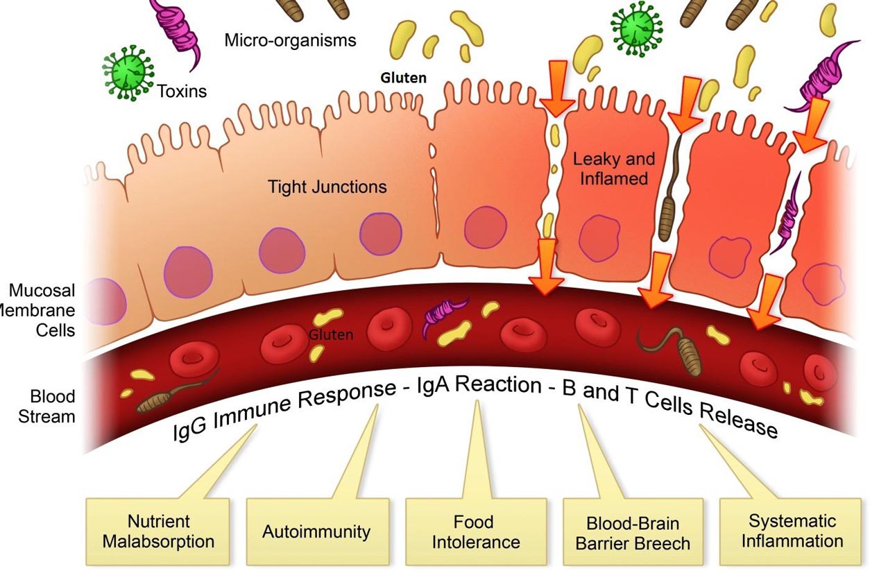 Heal Your Leaky Gut Program