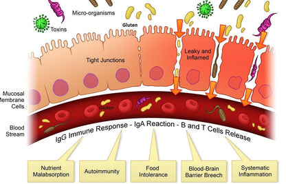 Heal Your Leaky Gut Program