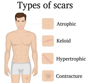 Scar/Adhesion Prevention WOUND and Surgical Site Health