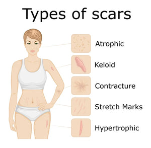 Scar/Adhesion Prevention WOUND and Surgical Site Health