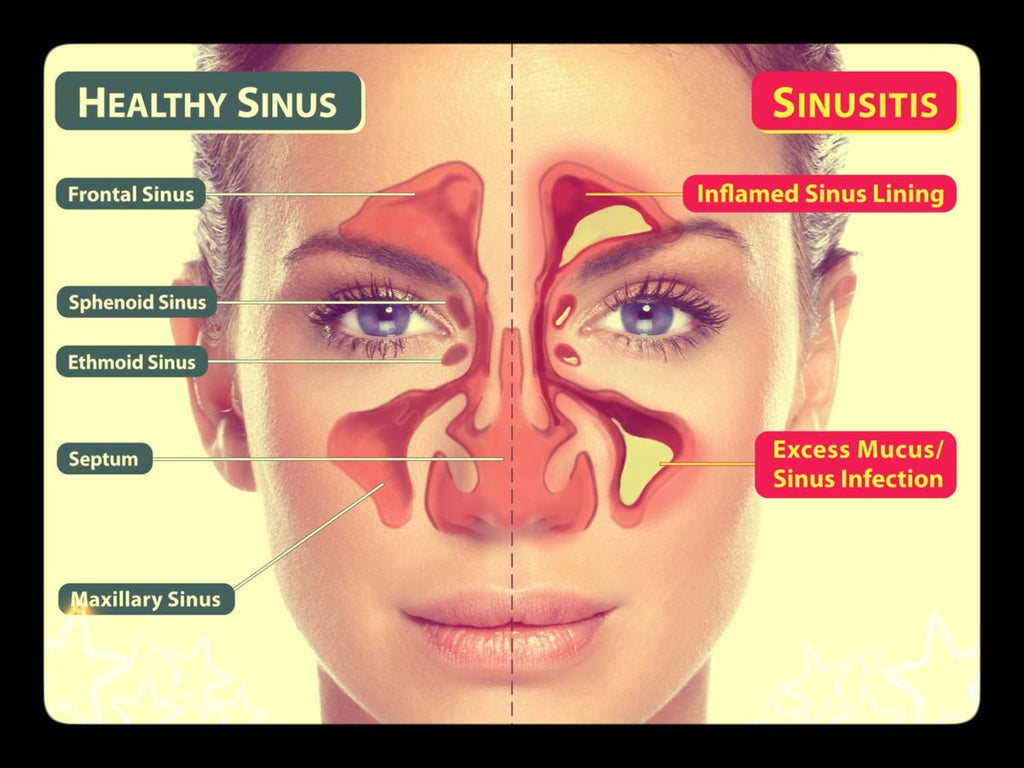 SINUS HEALTH PROGRAM