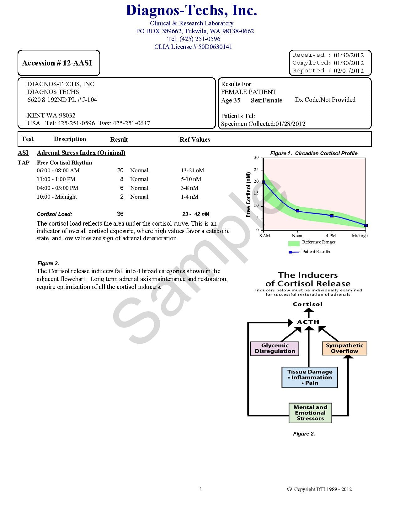 Adrenal Stress Index – ASI